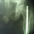 Imagem 2 da empresa FISIOTERAPIA(CONSULTORIO E DOMICILIAR) - ARMINDO PERDIGÃO Fisioterapia em Curitiba PR