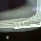 Imagem 3 da empresa FISIOTERAPIA(CONSULTORIO E DOMICILIAR) - ARMINDO PERDIGÃO Fisioterapia em Curitiba PR