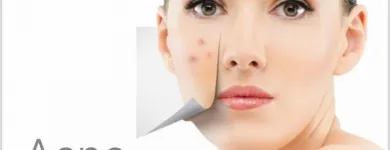 Imagem 2 da empresa DRª LILIAN SALVIATO DERMATOLOGISTA Clínicas De Dermatologia em Vitória ES
