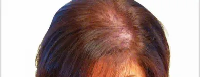 Imagem 1 da empresa DRª LILIAN SALVIATO DERMATOLOGISTA Clínicas De Dermatologia em Vitória ES