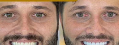 Imagem 2 da empresa ZANELATO ESTÉTICA DENTAL | TRATAMENTOS ODONTOLÓGICOS E ODONTOLOGIA DIGITAL Dentistas em Vitória ES