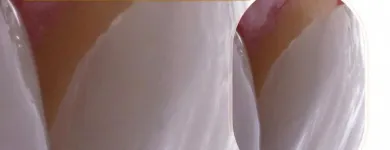 Imagem 3 da empresa ZANELATO ESTÉTICA DENTAL | TRATAMENTOS ODONTOLÓGICOS E ODONTOLOGIA DIGITAL Dentistas em Vitória ES